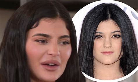 kylie jenner plastic surgery daily mail